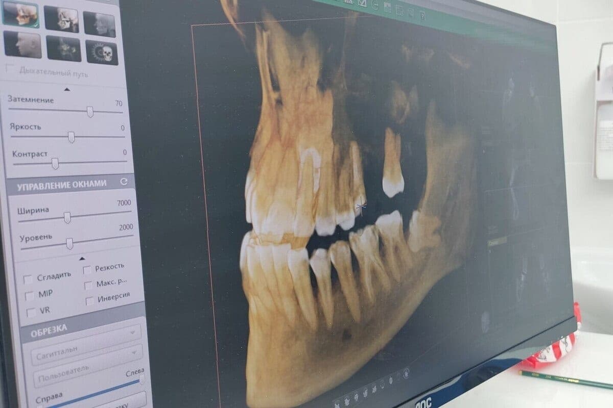 Dental clinic of Kaliningrad warned after the patient’s complaint