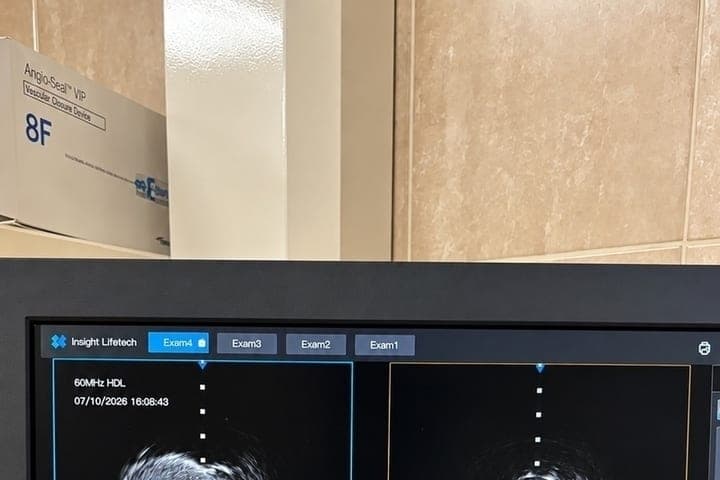 In the Great Luke branch of POKB began to do operations with intravascular ultrasound