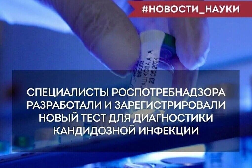 Роспотребнадзор разработал новый ПЦР‑тест для выявления Candida albicans