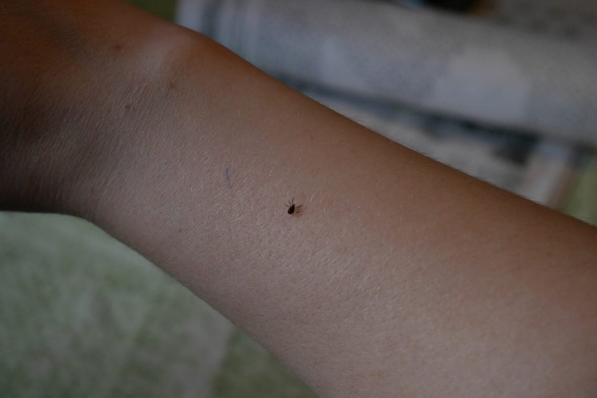During the season, ticks bitten about 13.9 thousand Vologda residents