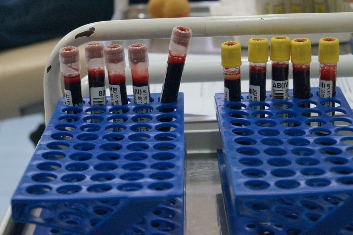 Vologzhan found out at the examination that he had hepatitis C