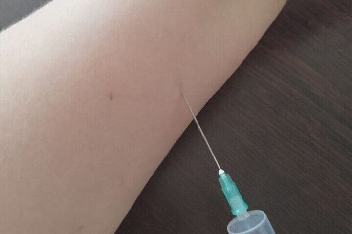 Pirogov Medical Center vaccinated very few northerners from diphtheria and tetanus