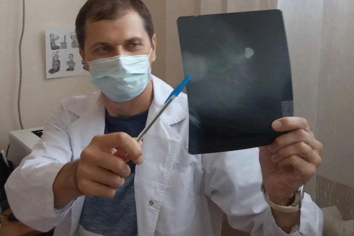 In Krasnodar, a woman with breast cancer removed the tumor and kept the implant
