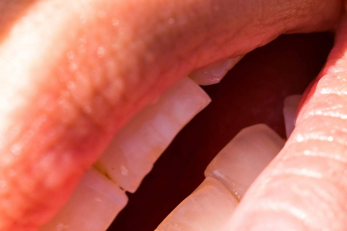 If the tooth is destroyed to the root, must it be removed? The dentist answered