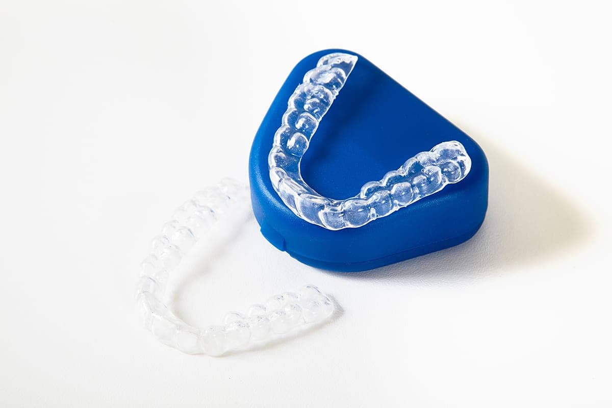 Les orthodontistes ont appelé les principales erreurs des patients avant de commencer le traitement par des eliners