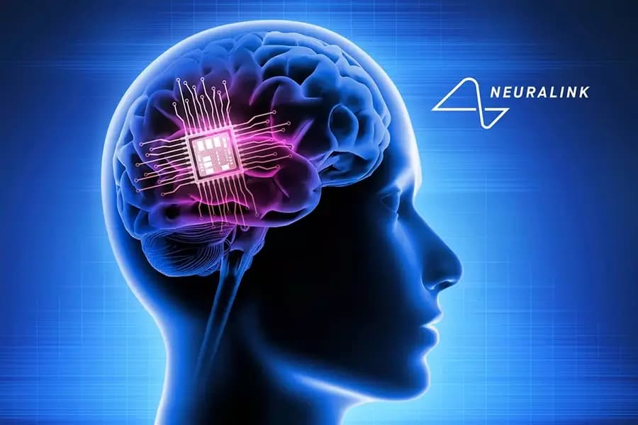 Чип в мозг по подписке: что может Neuralink сегодня, и стоит ли оно того