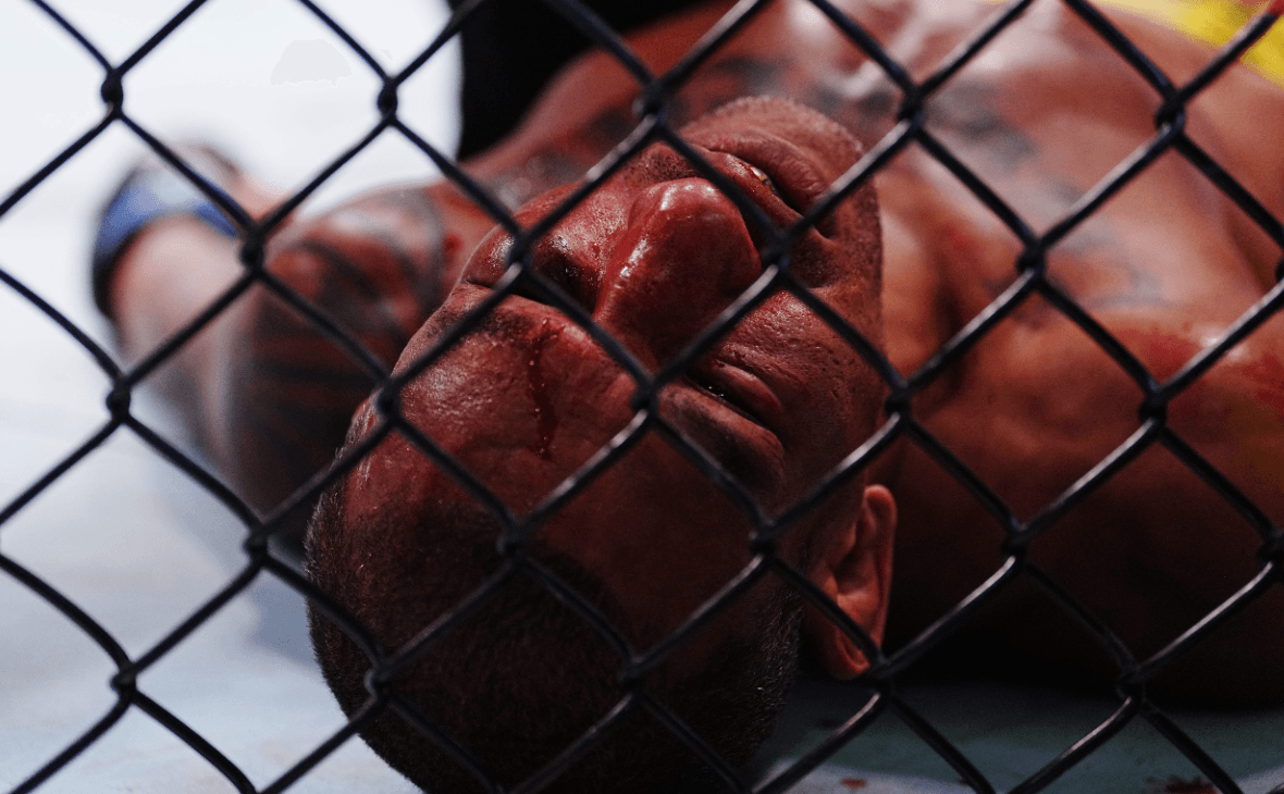 Бойца унесли без сознания из октагона после главного поединка турнира UFC