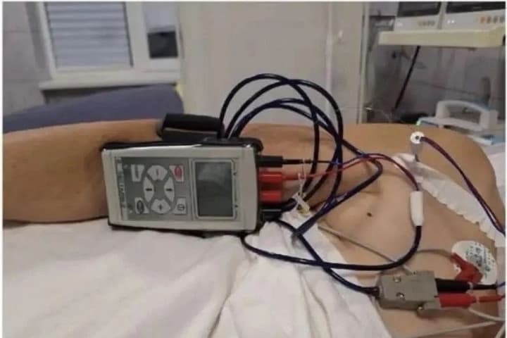 Специалисты из Кузбасса успешно вернули к жизни двоих больных с опасным для жизни замедлением сердечного ритма