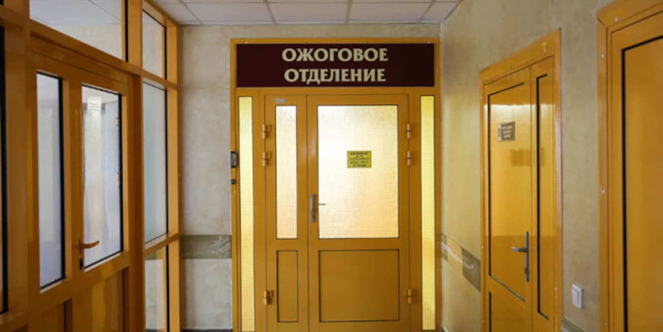 В Логойском районе мальчик получил ожоги головы, пытаясь поджечь слайм