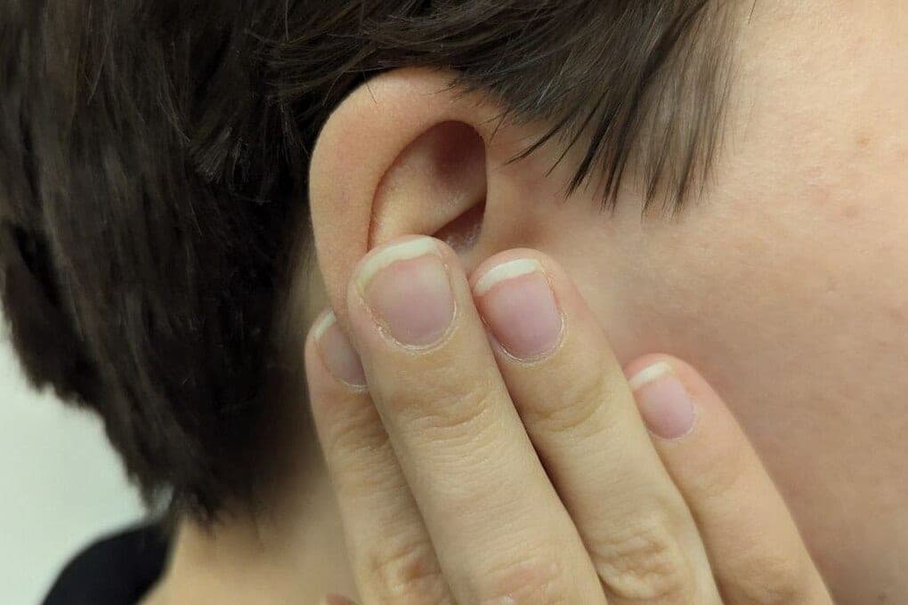 Northerners were reminded of the ability of cotton swabs to create sulfur plugs in the ears