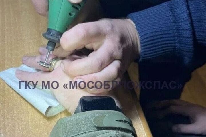 Пленник кольца: спасатели Мособлпожспаса помогли жителю Павловского Посада