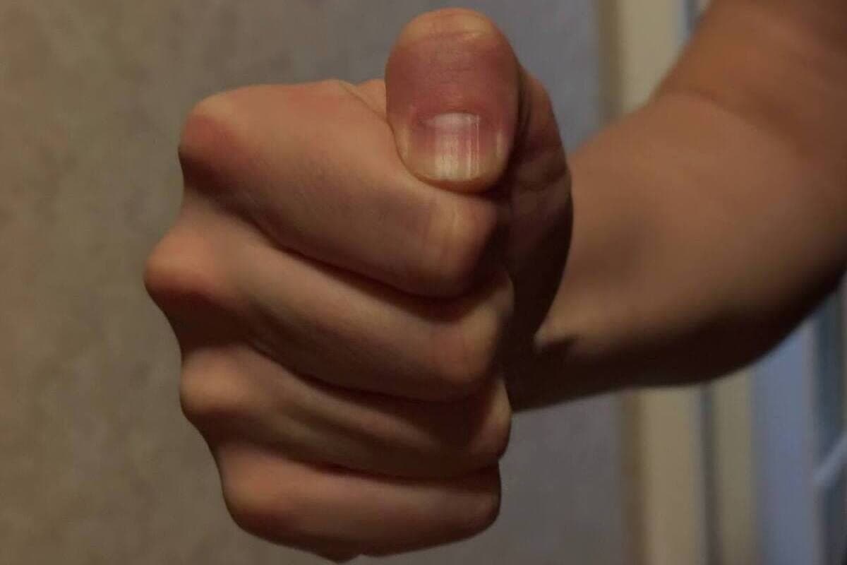 أحد سكان كراسنوزنامنسك حمله النـزاع الذي ألحقه مرتين بعصا مألوفة