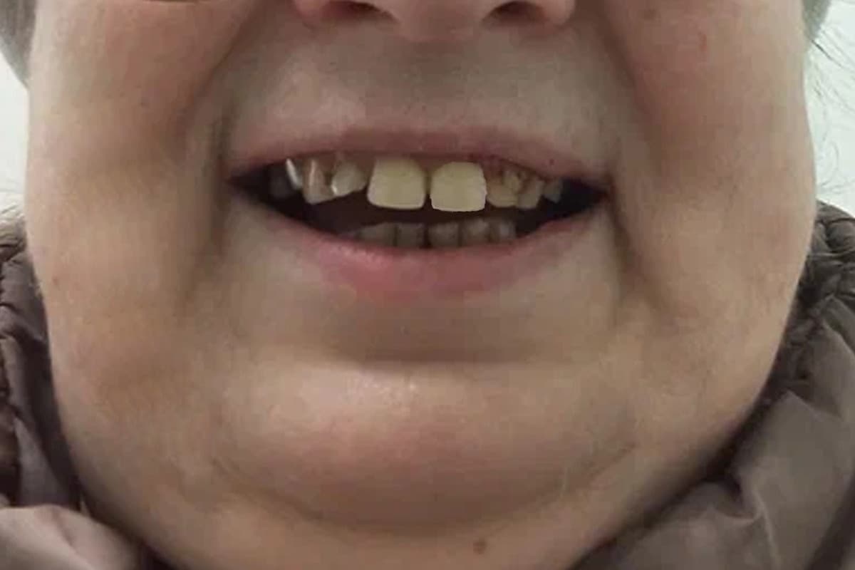 Покусавшая соседку жительница Великого Новгорода отделалась условным сроком